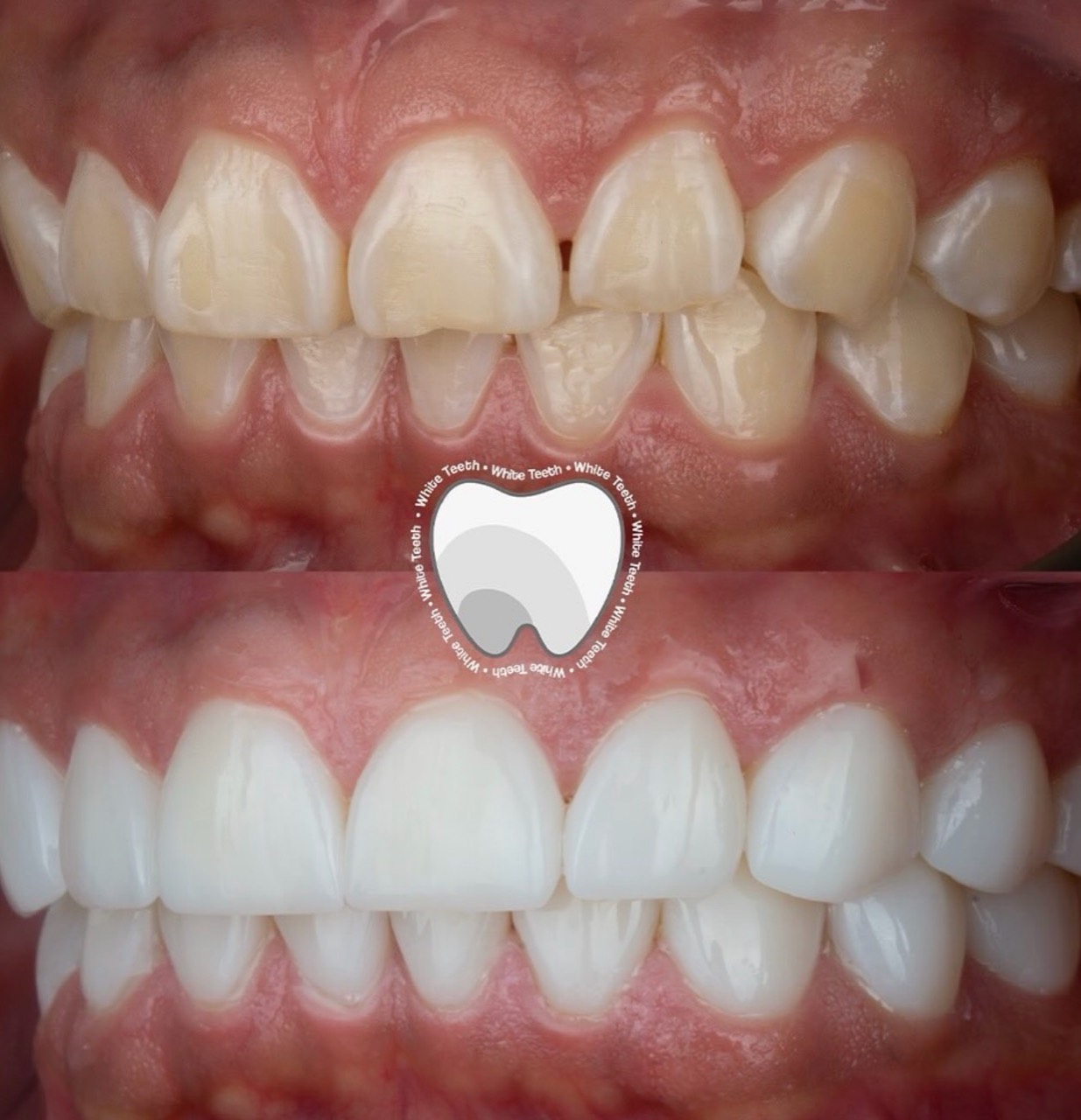 Dental aesthetic transformation before and after