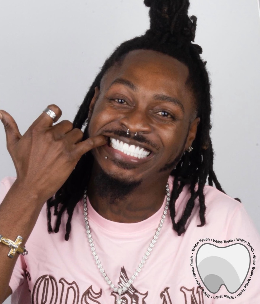 International patient porcelain veneers portrait