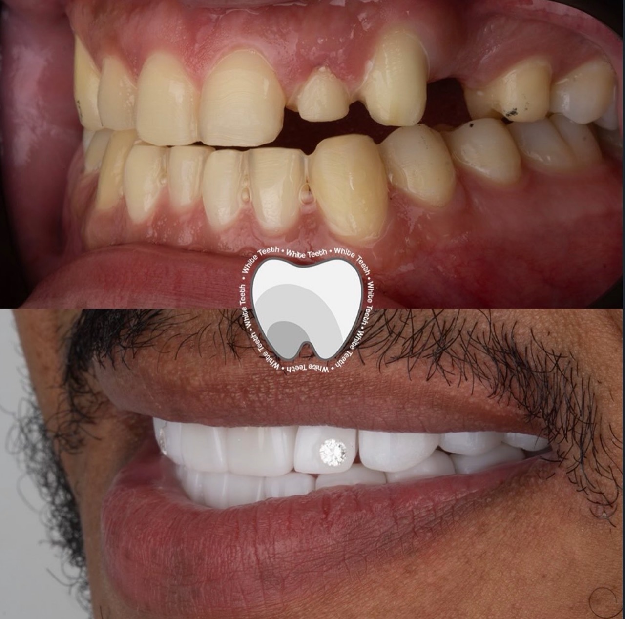 Complex dental rehabilitation before and after